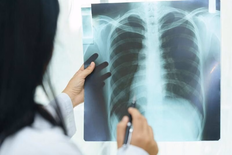 Bệnh nhân mắc xơ phổi đang thực hiện bài tập phục hồi chức năng hô hấp và hít thở sâu với sự hướng dẫn y tế