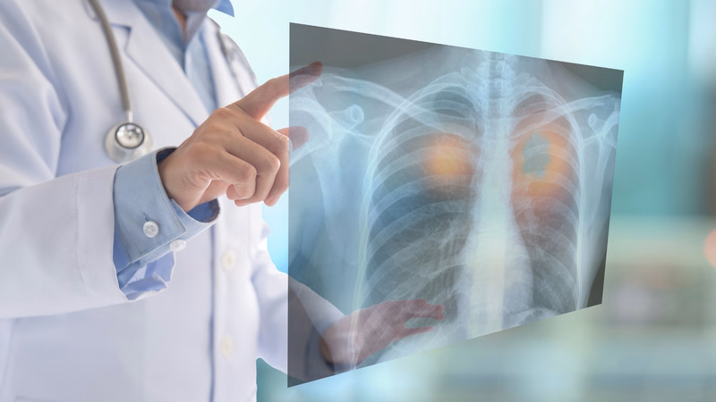 Bác sĩ đang phân tích hình ảnh chẩn đoán ung thư phổi