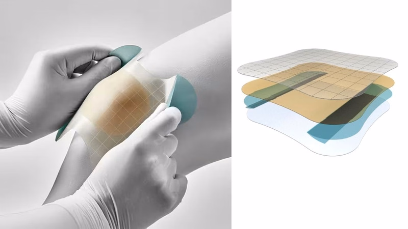 Băng dán hydrocolloid hỗ trợ hút dịch mụn và bảo vệ vết thương nông