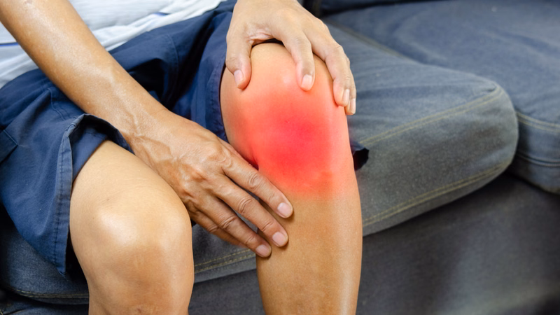 Khớp gối sưng phù căng tức do ứ đọng hoạt dịch sau chấn thương