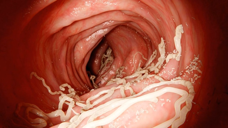 Xét nghiệm huyết thanh hỗ trợ bác sĩ chẩn đoán nhiễm giun đũa chó ở người