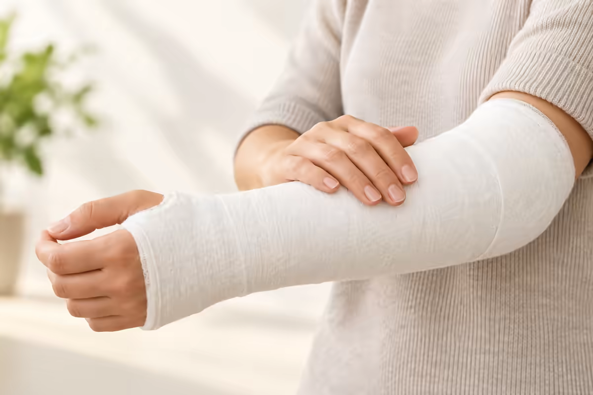 Cánh tay bó bột được chạm nhẹ bên ngoài