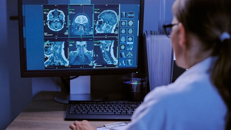 Kỹ thuật viên chuẩn bị quy trình chụp MRI sọ脑 cho người bệnh