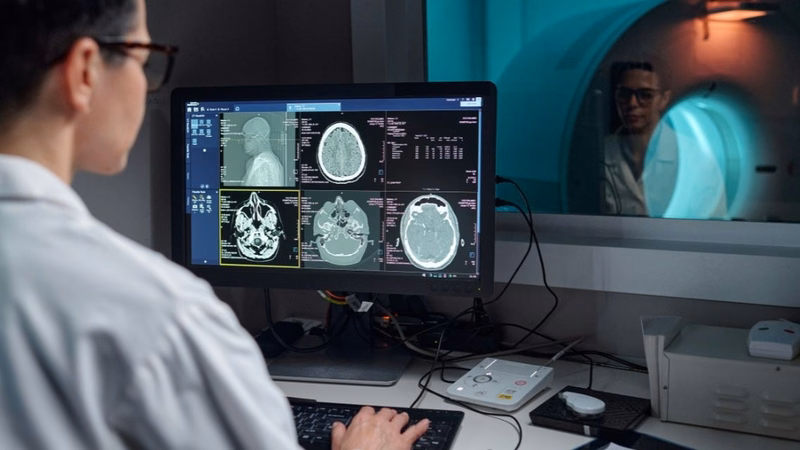 Máy chụp MRI hiện đại khảo sát cấu trúc脑 bộ