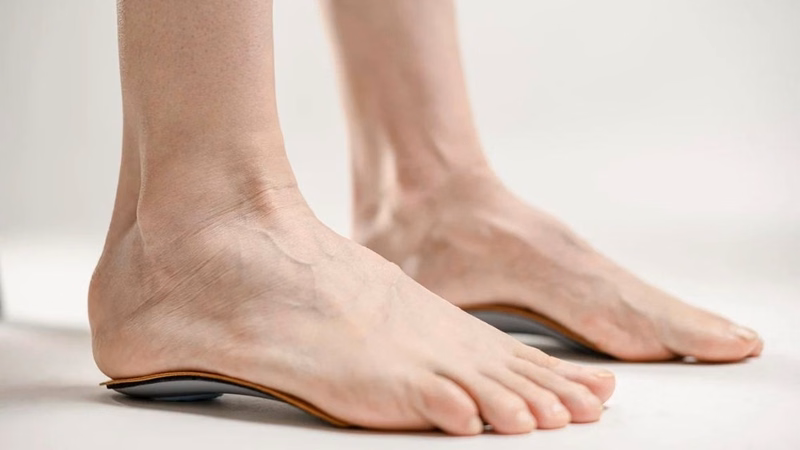 Đế chỉnh hình bàn chân bẹt hỗ trợ nâng đỡ vòm chân khi sử dụng trong giày