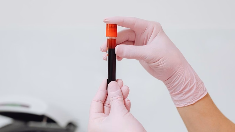 Sơ đồ giải thích ý nghĩa kết quả xét nghiệm HIV âm tính và thời điểm kiểm tra