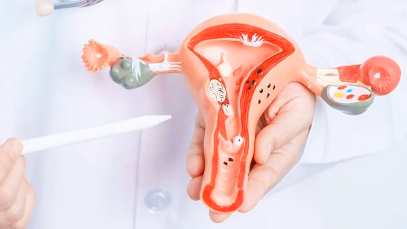 Căng thẳng kéo dài gây ảnh hưởng đến nội tiết tố và chu kỳ kinh nguyệt