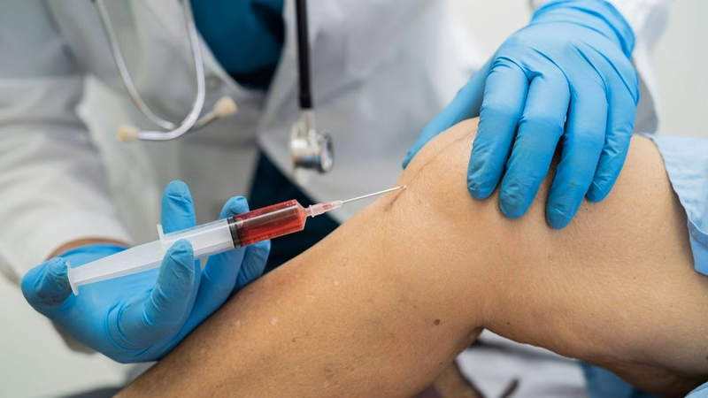 Ứng dụng Natri Hyaluronat trong hỗ trợ bôi trơn khớp và phục hồi mô da