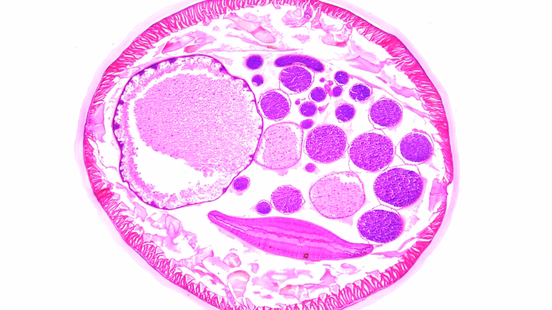 Hình ảnh minh họa ký sinh trùng đơn bào Trichomonas vaginalis gây nhiễm trùng đường sinh dục