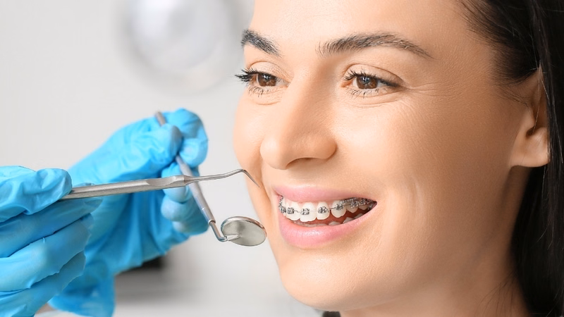 Bác sĩ nha khoa thăm khám và tư vấn phương pháp chỉnh nha phù hợp cho người trưởng thành