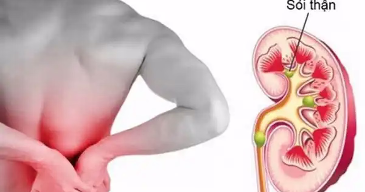 Tác hại của nước cứng đối với sức khỏe và sinh hoạt hàng ngày