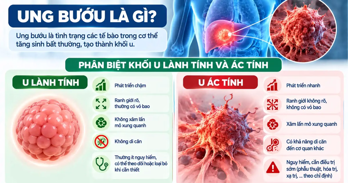 Ung bướu là gì và cách phân biệt khối u lành tính và ác tính