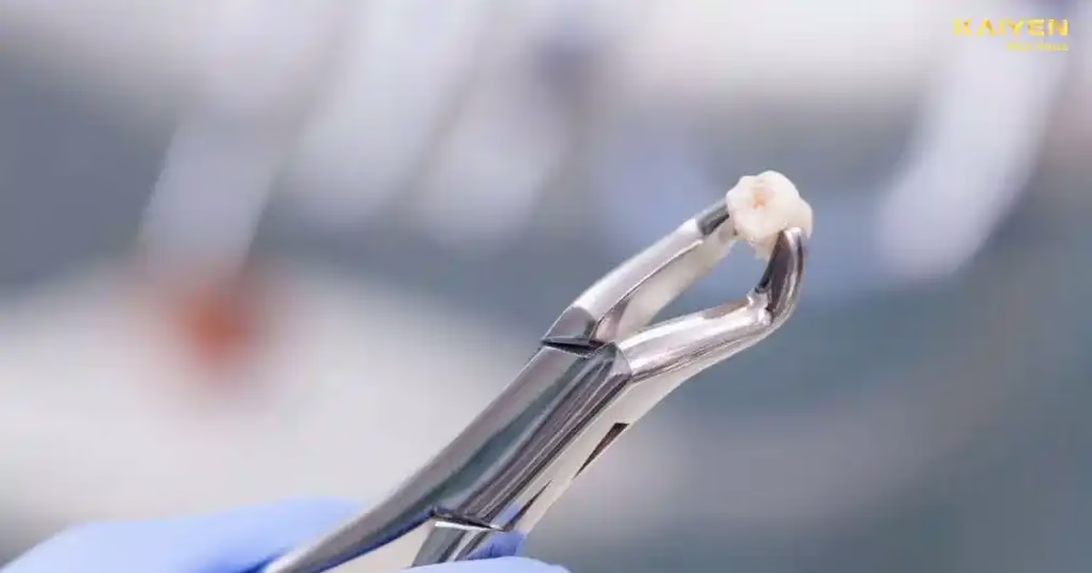 Người bị cao huyết áp có nhổ răng và làm thủ thuật nha khoa được không?
