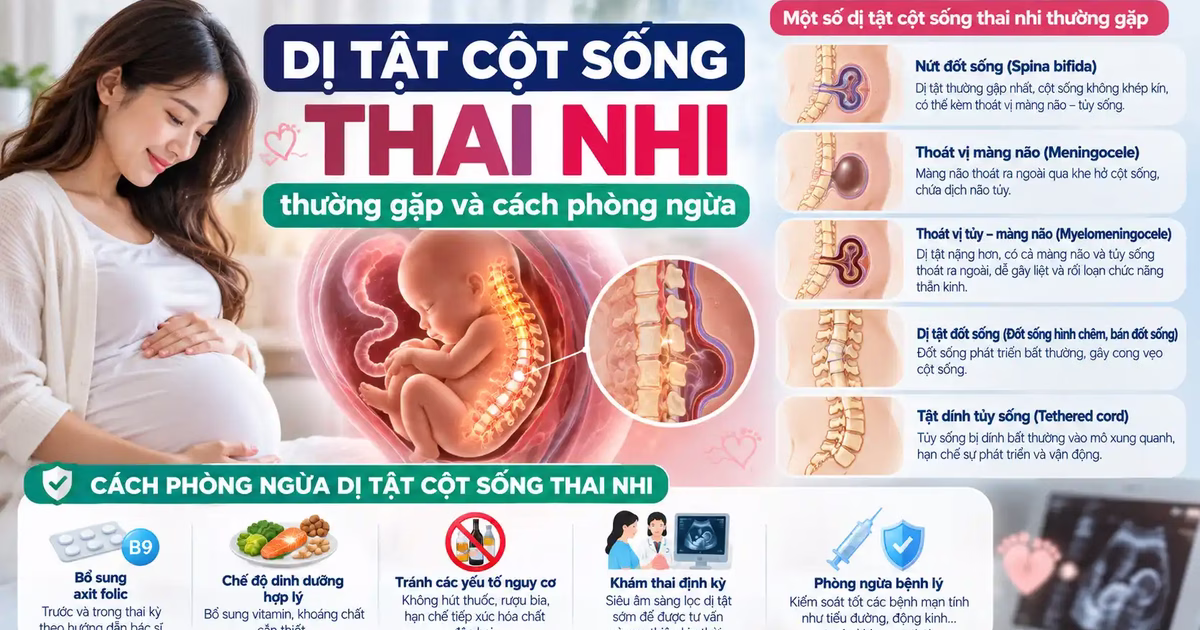 Dị tật cột sống thai nhi thường gặp và cách phòng ngừa
