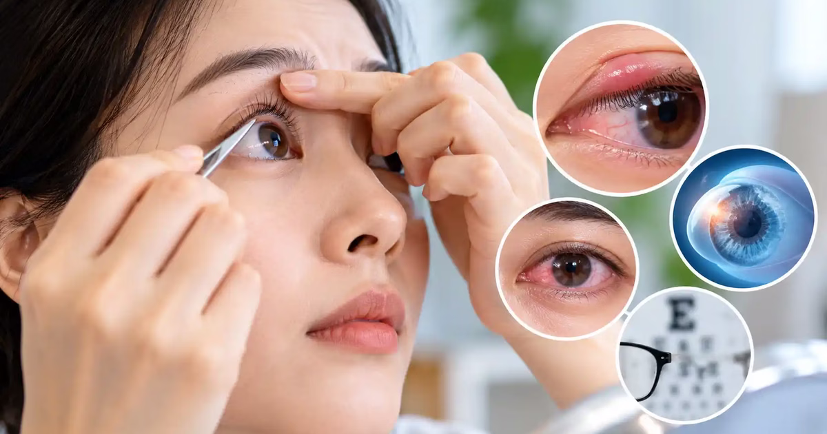 Bắt sâu mắt có thực sự tốt không và những nguy cơ gây hại cho mắt