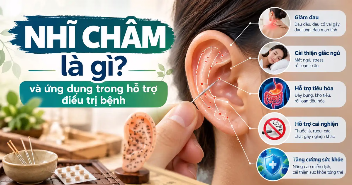 Nhĩ châm là gì và ứng dụng trong hỗ trợ điều trị bệnh