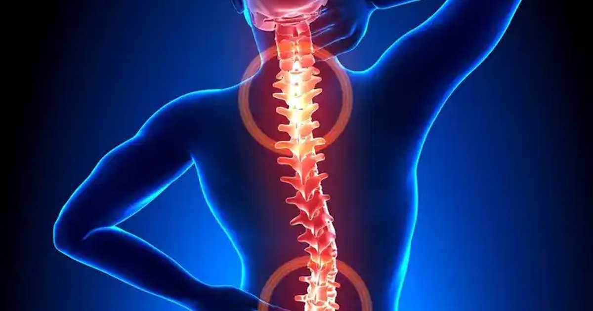 Các triệu chứng u tủy sống thường gặp và cảnh báo nguy hiểm