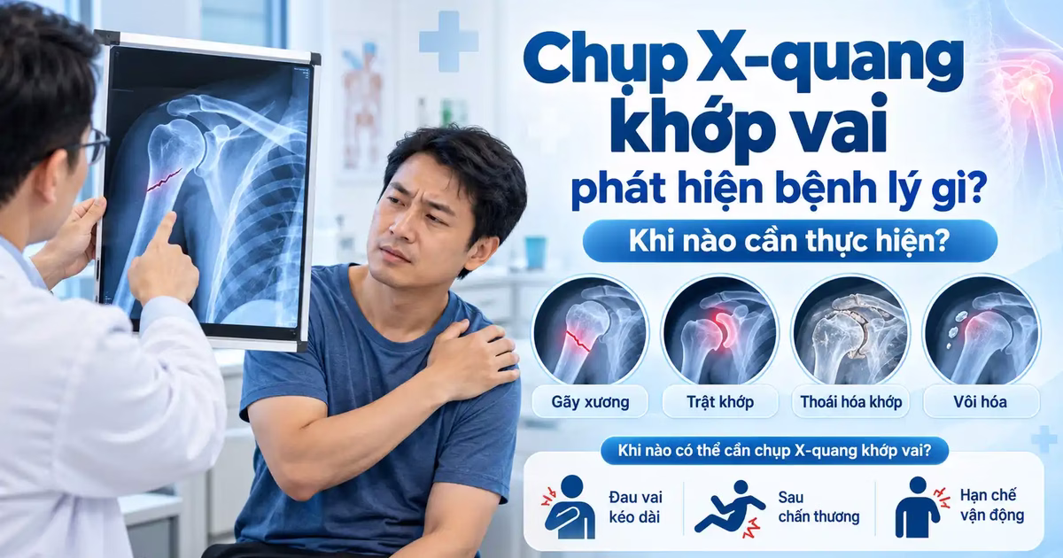 Chụp X-quang khớp vai phát hiện bệnh lý gì và khi nào cần thực hiện