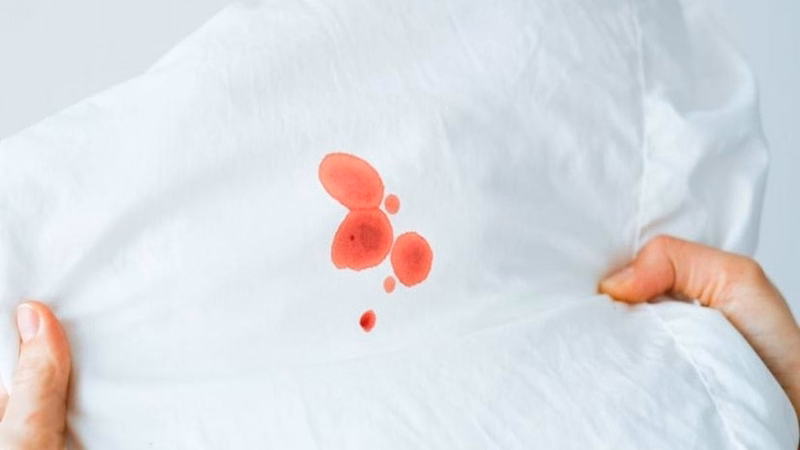 Minh họa tổn thương niêm mạc vùng sinh dục gây chảy máu đỏ tươi ở nam giới sau khi quan hệ