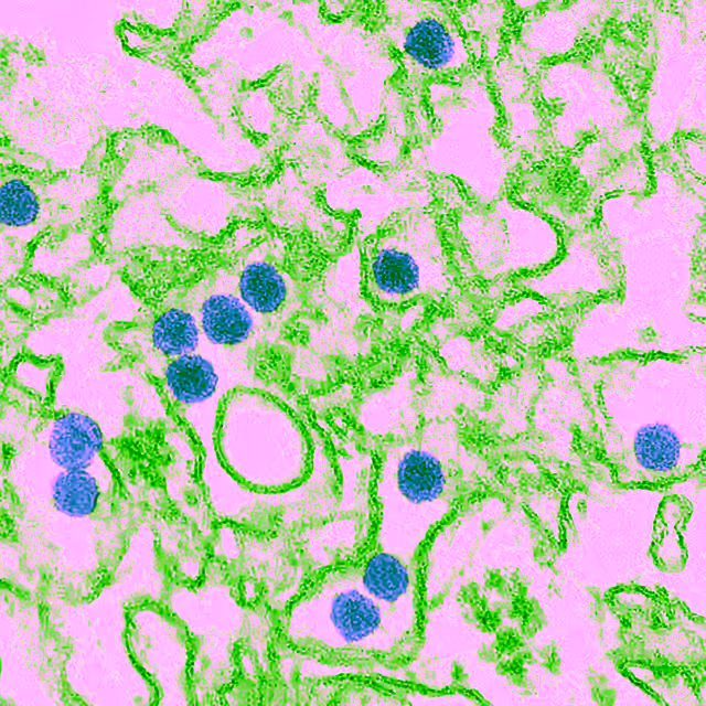 Hình hiển vi các hạt virus Zika