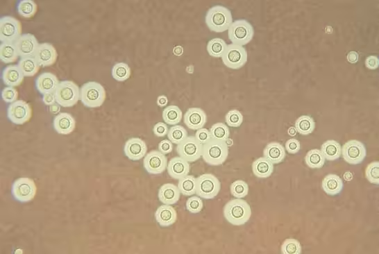 Hình hiển vi các tế bào nấm Cryptococcus