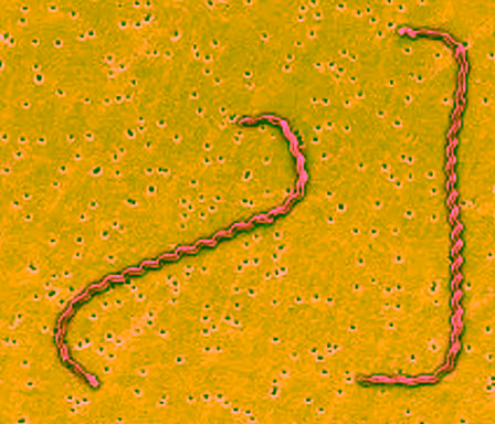 Hình hiển vi vi khuẩn Leptospira dạng xoắn