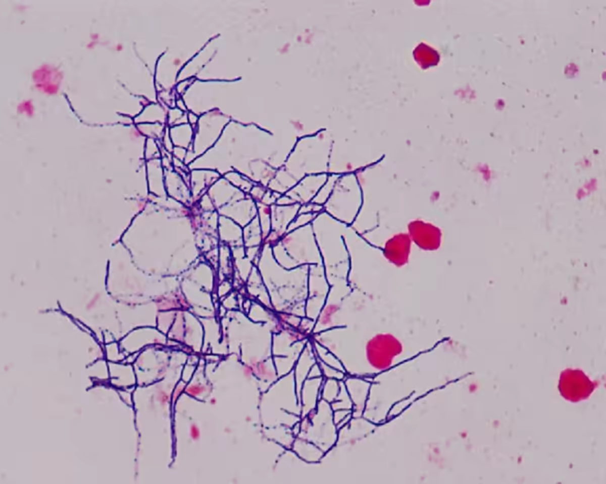 Hình hiển vi vi khuẩn Nocardia dạng sợi phân nhánh