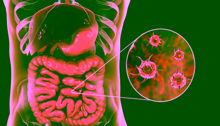 Minh họa vi khuẩn Shigella và đường ruột bị ảnh hưởng