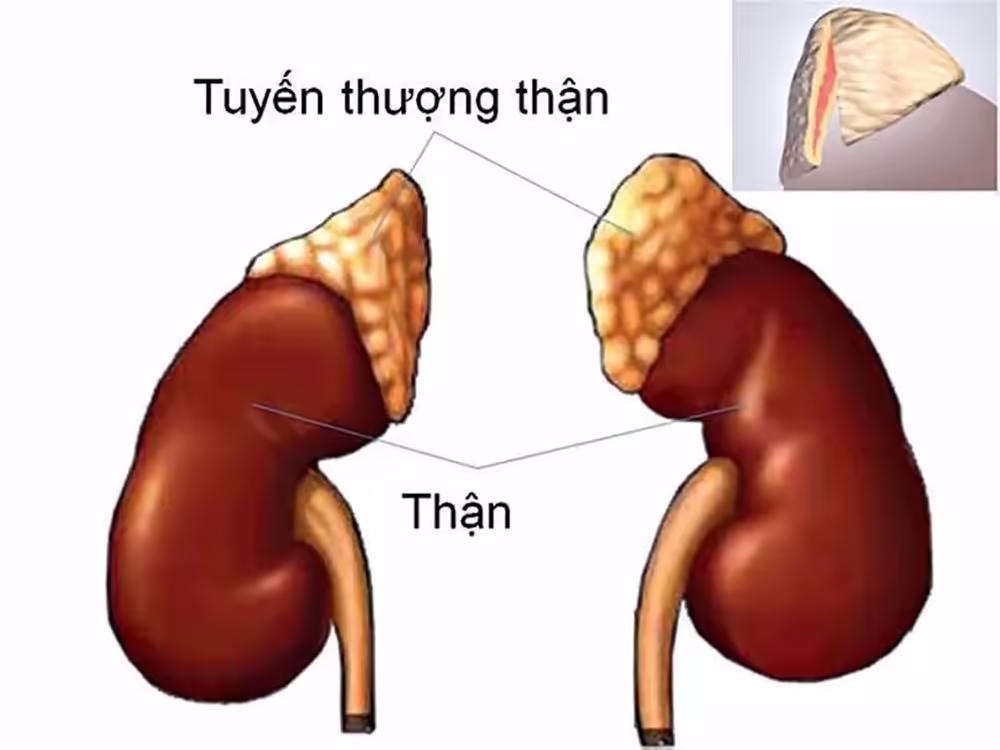Hình minh họa tuyến thượng thận nằm trên hai quả thận