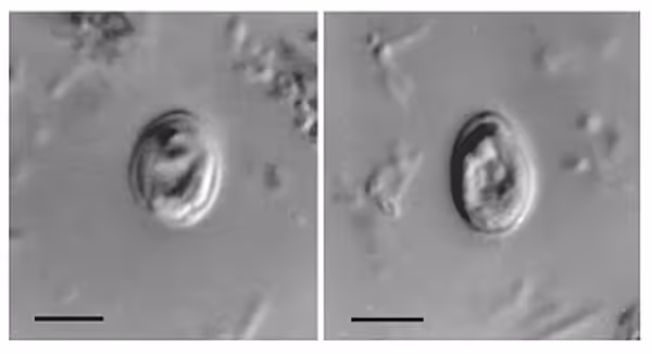 Hình hiển vi nang trứng Cryptosporidium trong mẫu bệnh phẩm