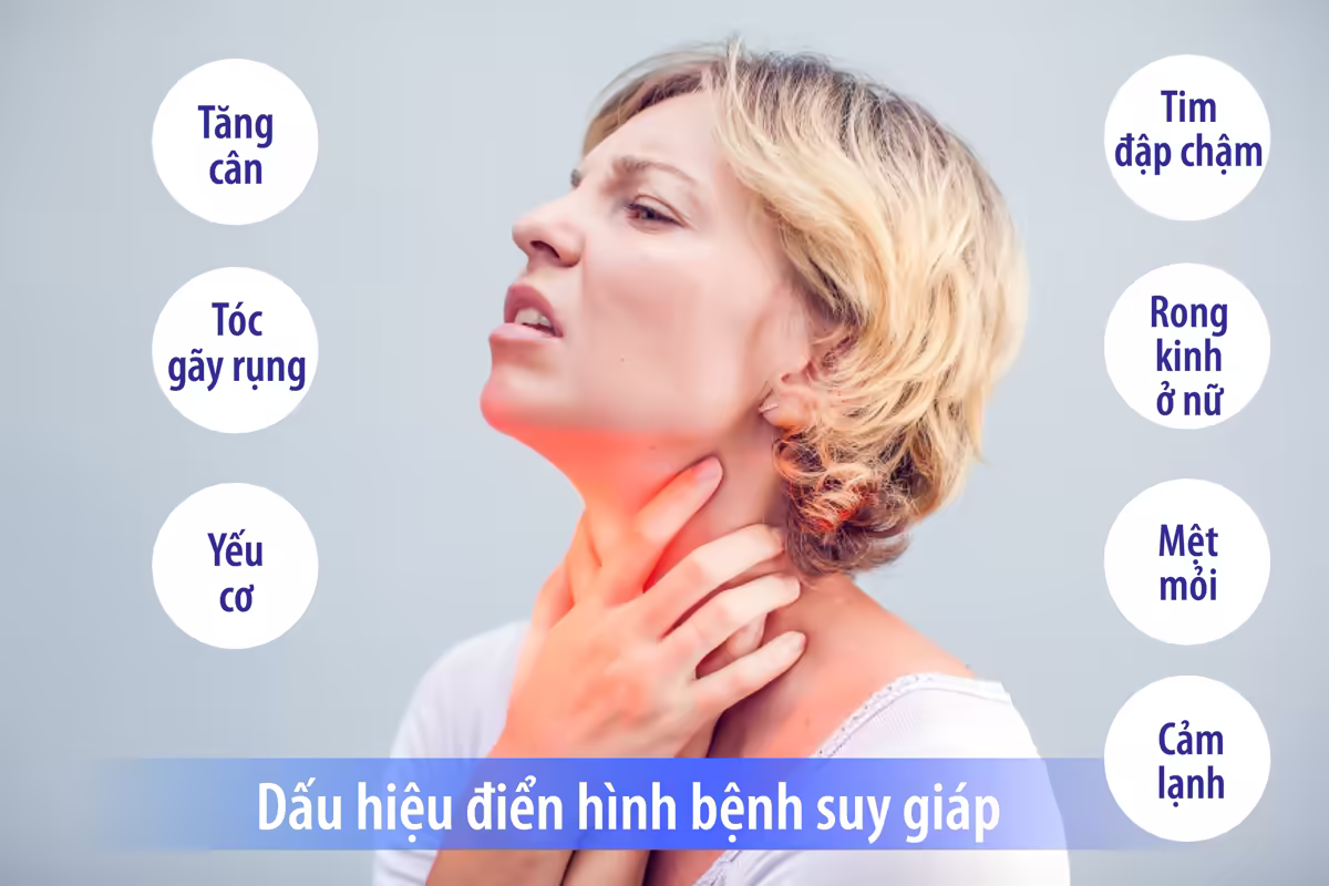 Người bệnh suy giáp mệt mỏi, tăng cân và cảm giác lạnh
