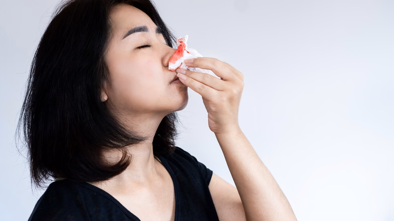 Theo dõi dấu hiệu cảnh báo xuất huyết khi dùng thuốc chống đông