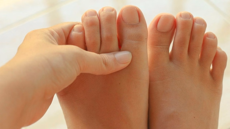 Hình ảnh ngón chân bị sưng đau và biến dạng cần được bác sĩ kiểm tra