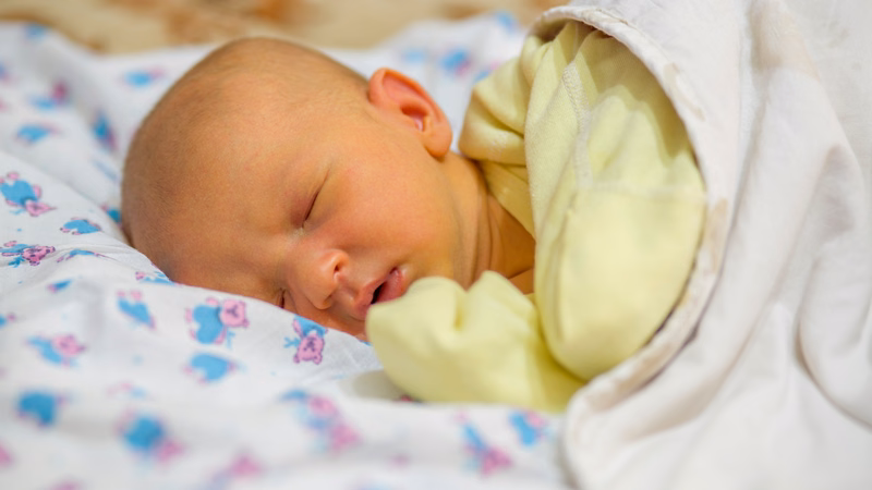 Hình ảnh trẻ sơ sinh bị vàng da tắc mật cần được theo dõi và thăm khám y khoa sớm
