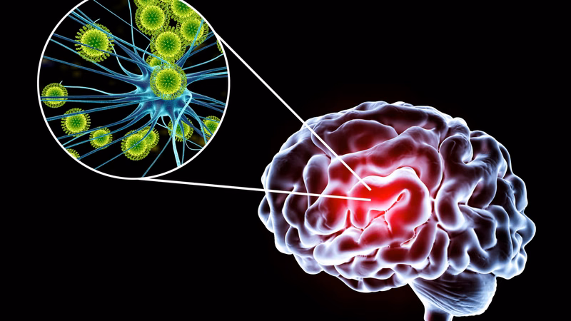 Hình ảnh minh họa con đường lây truyền âm thầm của vi khuẩn brain mô cầu qua đường hô hấp trong cộng đồng