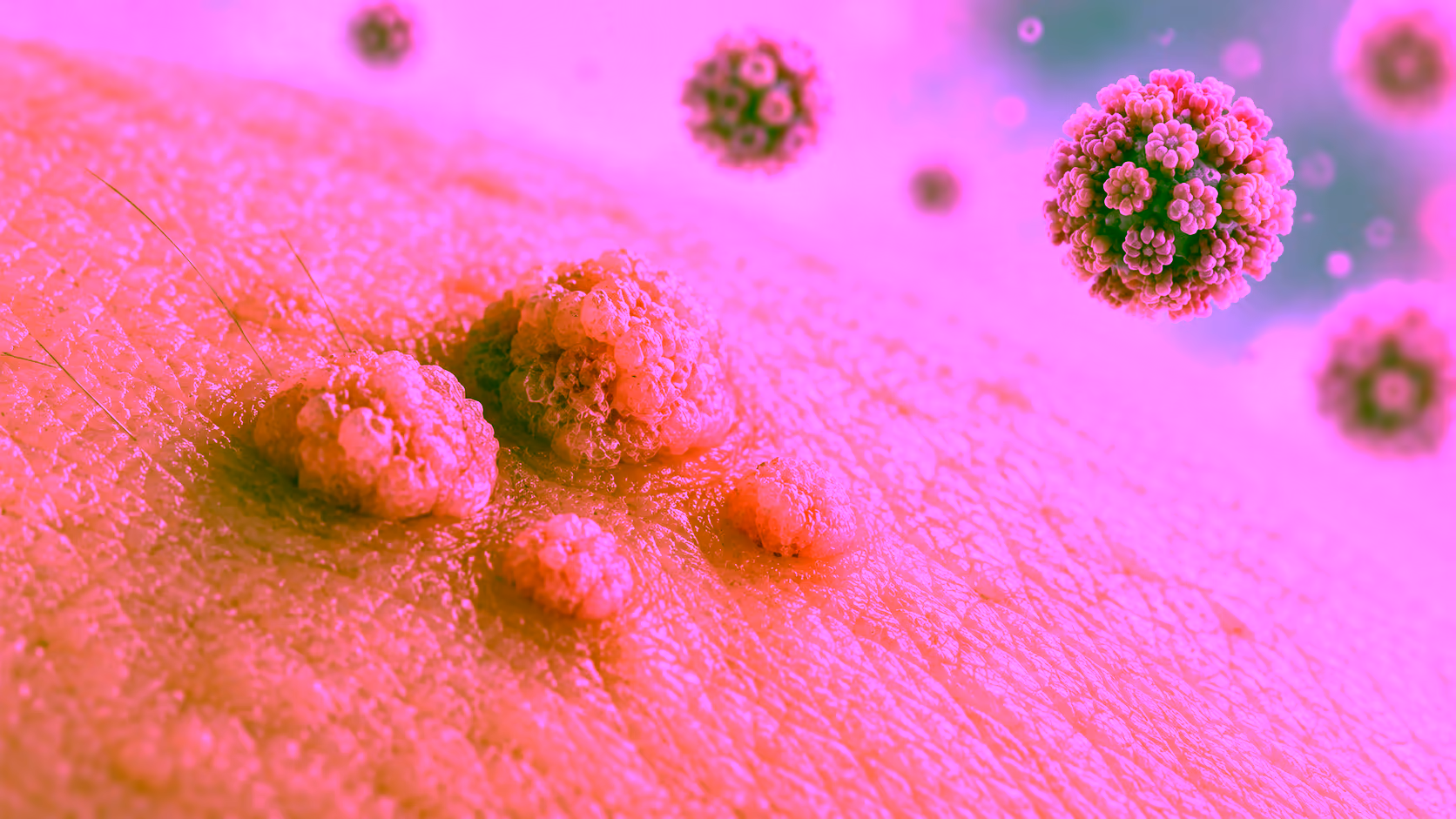 Minh hoạ tổn thương da liên quan HPV