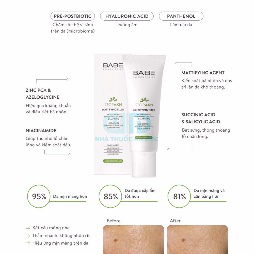 Kem dưỡng kiềm dầu ngừa mụn BABE Stop AKN Mattifying Fluid - Hình 1