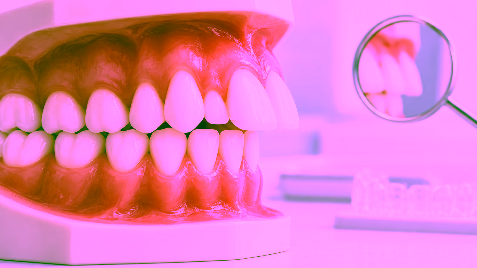 Minh hoạ răng thỏ và khớp cắn