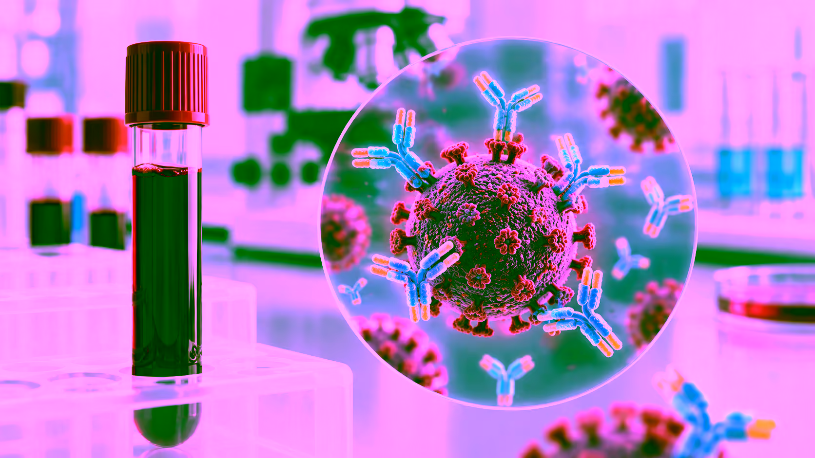 Minh hoạ xét nghiệm Rubella IgG