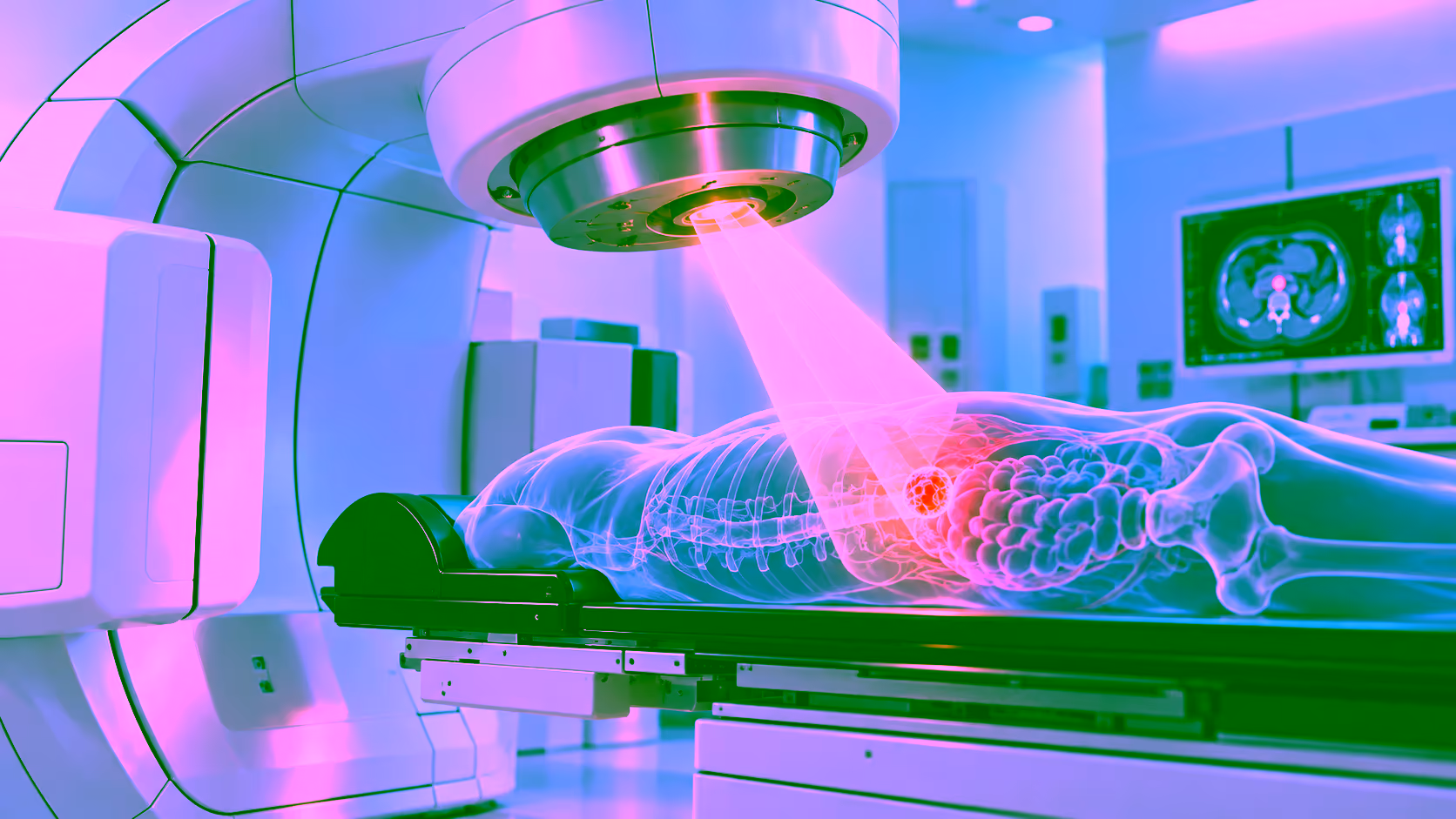 Minh hoạ xạ trị Cobalt-60
