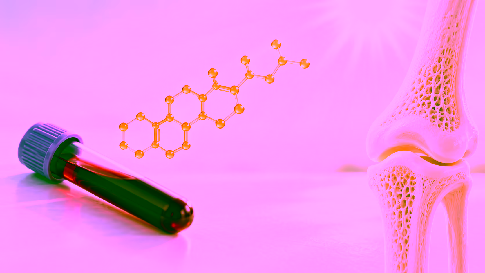 Minh hoạ xét nghiệm vitamin D và xương