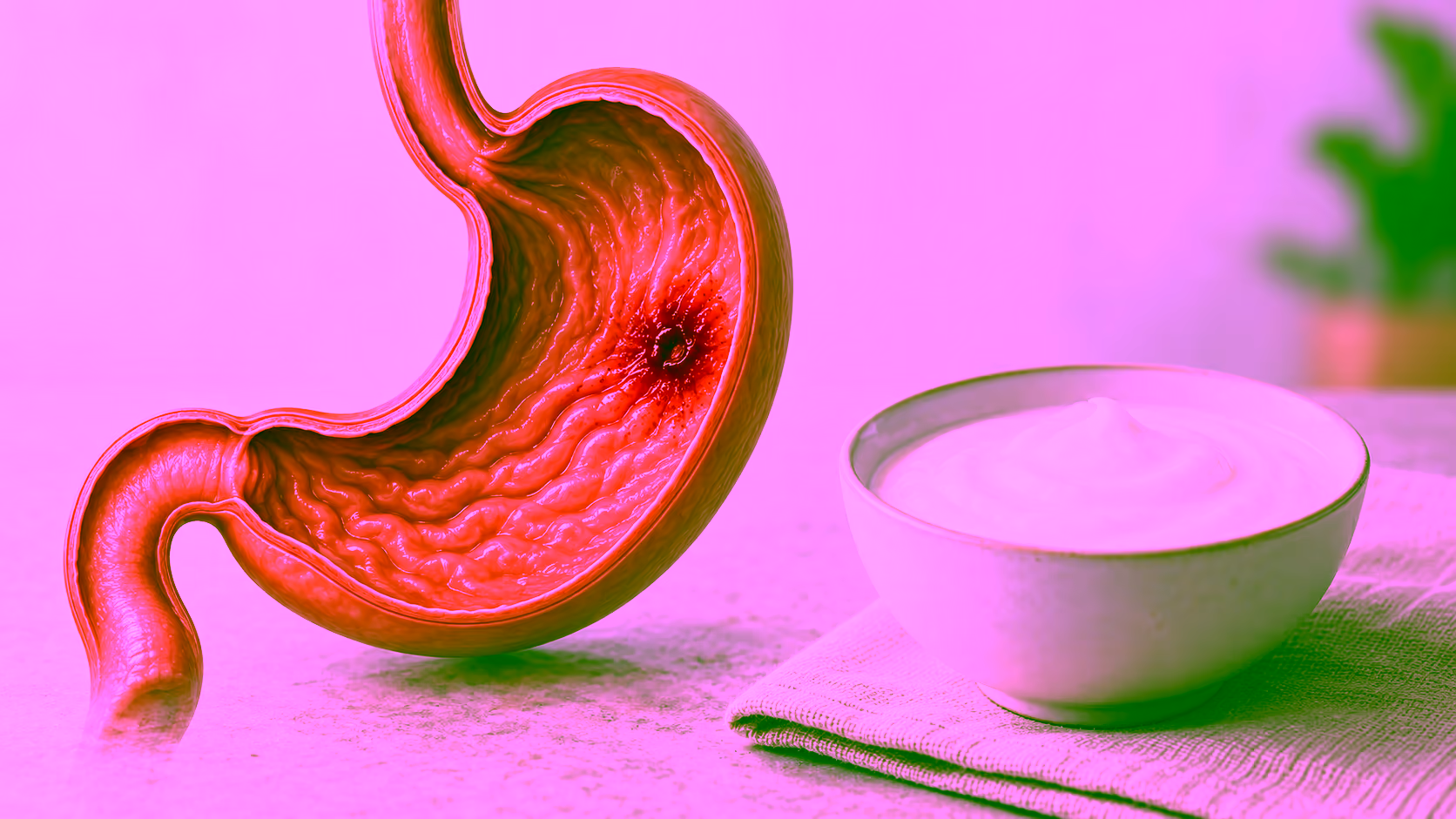 Minh hoạ xuất huyết dạ dày và sữa chua