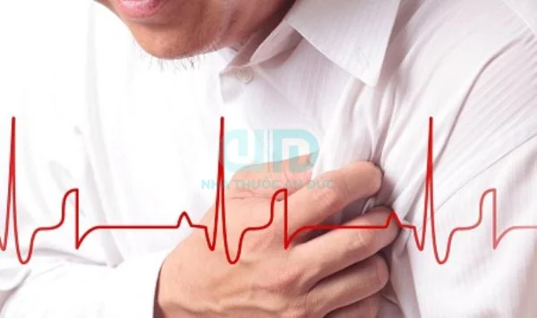 Người đàn ông ôm ngực đau đớn với hình ảnh điện tâm đồ minh họa cho nhồi máu cơ tim